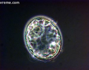 Veliki mali embrion 3