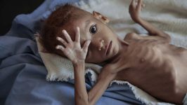 UN: Glad nova realnost za 18 miliona ljudi 2